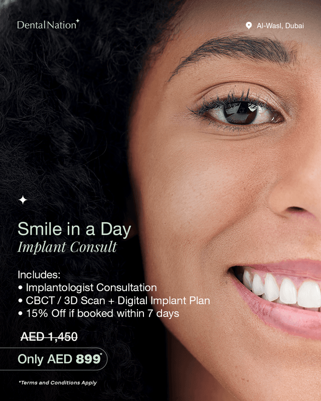 Smile in a Day - Implant Consult