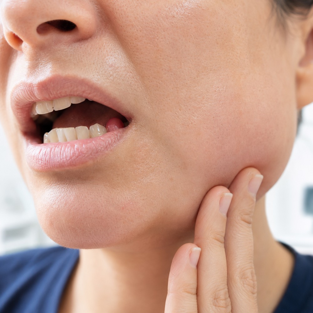 Swelling or suspected abscess
